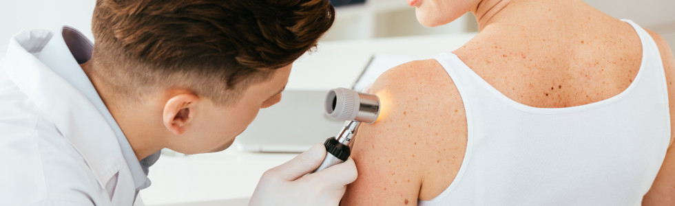 Ein Arzt untersucht Leberflecke auf der Haut einer Frau mit dem Dermatoskop — jetzt Dermatoskop kaufen!
